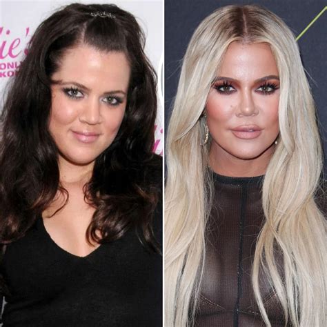 khloe kardashian before and after